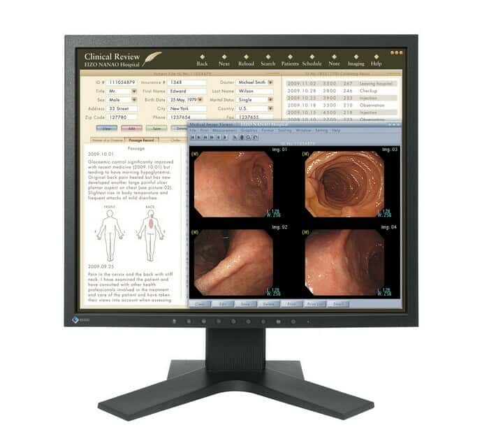 نمایشگر پزشکی Medical LED، LCD ایزو RadiForce MX19155758